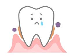 歯を失う原因とは？