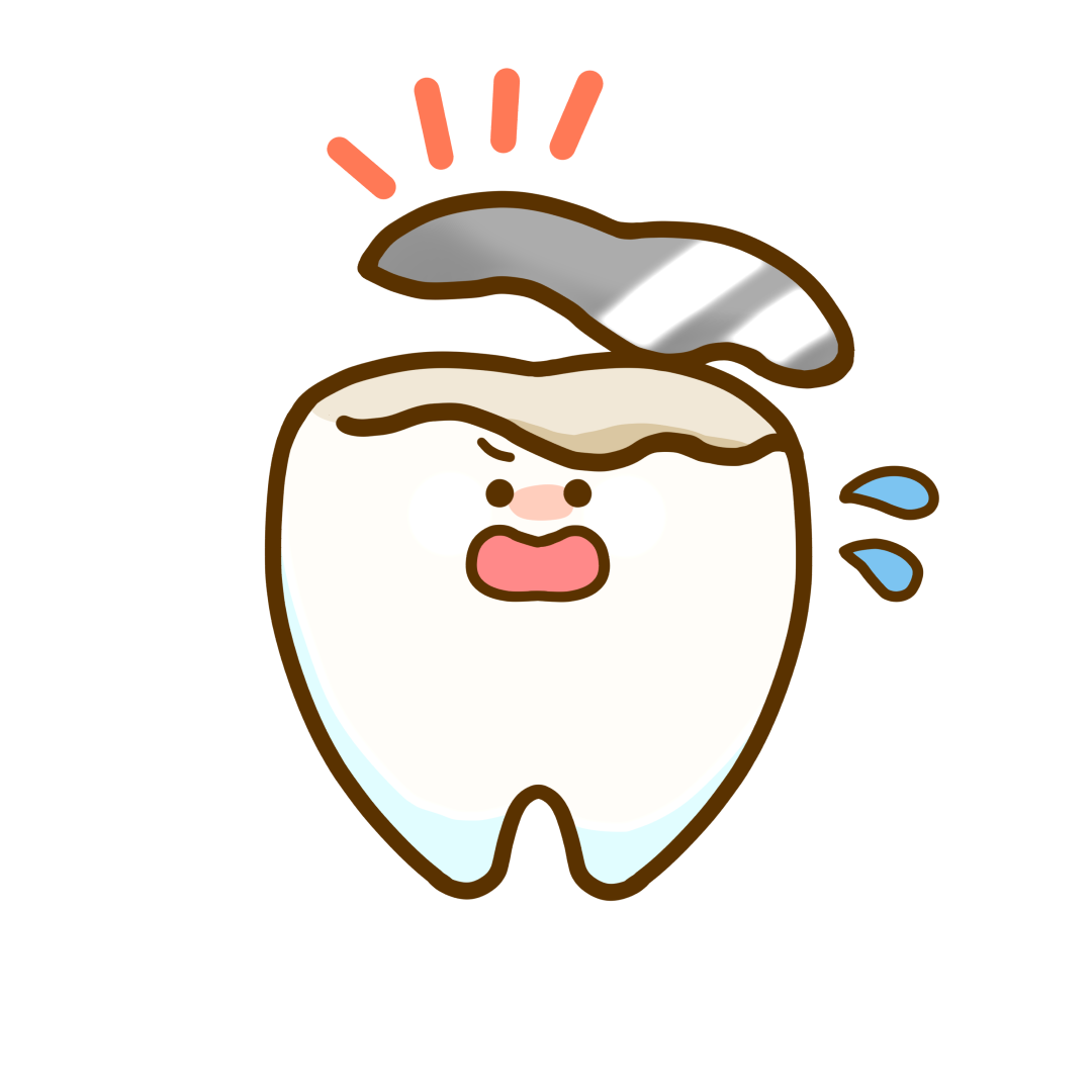 銀歯の二次むし歯について