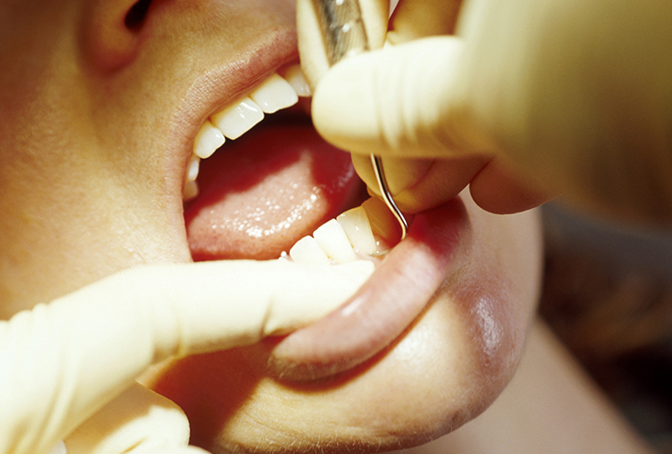 日本と海外では歯科治療に差があるのをご存じですか？